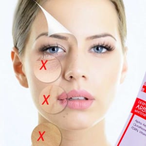 kem đặc trị nám